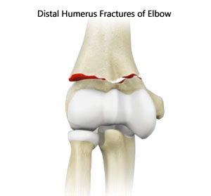 distal humerus anatomy