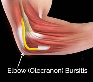 Elbow Olecranon