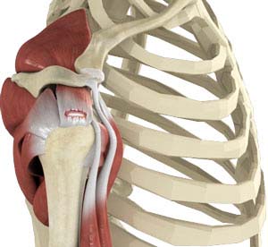  Rotator Cuff Tear